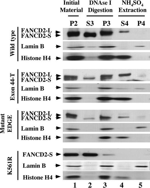 Figure 6. Monoubiquitination is required for targeting of FANCD2 to the chromatin fraction. PD-20Fs (FA-D2 fibroblasts) were stably transduced with retroviral constructs encoding HA-FANCD2-44 (wild type), HA–Exon44-T, HA–mutant EDGE, or HA–FANCD2-K561R. Cells were pretreated with MMC to increase the level of FANCD2-L to approximately 50% of total cellular FANCD2. Cells were then fractionated as described in Figure 5A, and fractions were immunoblotted with antisera to FANCD2, histone H4, or lamin B. Fractions are shown beginning with the detergent-insoluble pellet following permeabilization (P2).