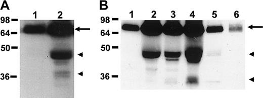 Figure 7. Generation of angiostatin during wound healing. (A) The expression of plasminogen (arrow) and angiostatin forms (arrowheads) in normal cutaneous tissue (lane 1) as well as in a 5-day-old wound (lane 2) is shown. (B). The expression of plasminogen (arrow) and angiostatin forms (arrowheads) in wounds that were extracted at day 0 (lane 1), day 1 (lane 2), day 3 (lane 3), day 7 (lane 4), or day 10 (lane 5) after wound generation. Lane 6 indicates purified plasminogen (0.5 μg).