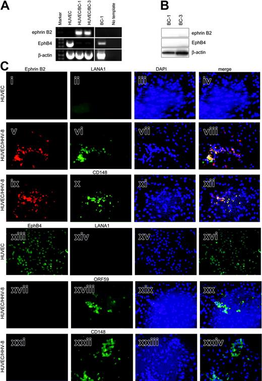 Figure 2. HHV-8 induces arterial marker expression in venous endothelial cells. (A) RT-PCR of HUVECs, 2 HHV-8-infected cultures (HUVEC/BC-1 and HUVEC/BC-3), and BC-1 for ephrin B2 and EphB4. Ephrin B2 product (200 bp) is seen in HUVEC/BC-1 and HUVEC/BC-3, and EphB4 product (400 bp) is seen in HUVECs and BC-1. No template lane had exactly the same reaction components and conditions, except template cDNA was omitted. This is included to show the specificity of the amplified products. β-Actin RT-PCR is also shown as a control for amount and integrity of input RNA. (B) Western blot of protein extracts of BC-1 and BC-3 HHV-8-positive cell lines. Membranes were sequentially probed with ephrin B2, EphB4, and β-actin monoclonal antibodies. Specific bands were detected at 120 kDa for EphB4, 37 kDa for ephrin B2, and 40 kDa for β-actin. (C) Immunofluorescence of cultures of HUVECs and HUVEC/BC-1 for artery/vein markers and viral proteins. Cultures were grown on chamber slides and processed for immunofluorescence detection of ephrin B2 (i, v, ix), EphB4 (xiii, xvii, xxi), CD148 (x, xxii), and the HHV-8 proteins LANA1 (ii, vi, xiii) or ORF59 (xviii) as described in “Patients, materials, and methods.” Yellow color in the merged images of the same field demonstrate coexpression of ephrin B2 and LANA or ephrin B2 and CD148. The positions of viable cells were revealed by nuclear staining with DAPI (blue) in the third column (iii, vii, xi, xv, xix, xxiii). Photomicrographs are of representative fields.