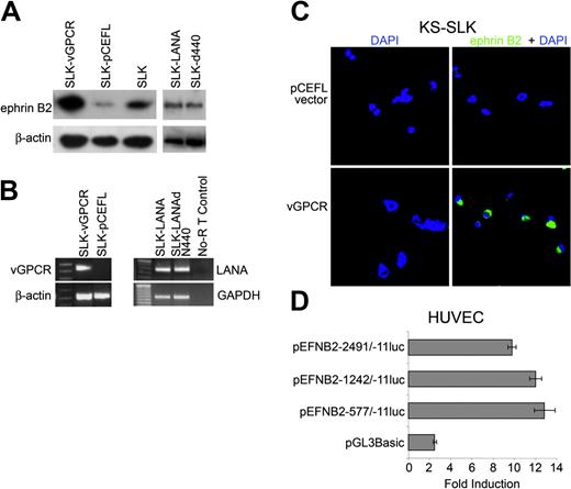 Figure 3. HHV-8 induces arterial marker expression in Kaposi sarcoma cells. (A) Western blot for ephrin B2 on various cell lysates. SLK-vGPCR is a stable clone of SLK expressing the HHV-8 vGPCR, and SLK-pCEFL is control stable clone transfected with empty expression vector. SLK cells transfected with LANA or LANAΔ440 are SLK-LANA and SLK-Δ440, respectively. Quantity of protein loading and transfer was determined by reprobing the membranes with β-actin monoclonal antibody. (B) RT-PCR of stable cell lines shown in panel A, demonstrating expression of the relevant viral mRNAs. Housekeeping mRNA to demonstrate equivalent input mRNA and loading was β-actin or glyceraldehyde-3-phosphate dehydrogenase (GAPDH). Specific bands of the expected sizes (Table 1) were obtained with all gene-specific primer pairs. (C) Transient transfection of KS-SLK cells with expression vector pCEFL-KSHV-GPCR resulted in the expression of ephrin B2 as shown by immunofluorescence staining with FITC (green), whereas the control vector pCEFL had no effect. KS-SLK cells (0.8 × 105/well) were transfected with 0.8 μg DNA using Lipofectamine 2000. Twenty-four hours later cells were fixed and stained with ephrin B2 polyclonal antibody and FITC-conjugated secondary antibody as described in “Patients, materials, and methods.” (D) Transient transfection of HUVECs with vGPCR induces transcription from ephrin B2 luciferase constructs. HUVECs (8 × 103) in 24-well plates were transfected using Superfect with 0.8 μg/well ephrin B2 promoter constructs containing sequences from -2941 to -11 with respect to the translation start site, or 2 5′ deletions as indicated, together with 80 ng/well pCEFL or pvGPCR-CEFL. Luciferase was determined 48 hours after transfection. pGL3Basic is promoterless luciferase control vector. Luciferase was normalized to protein since GPCR induced expression of the cotransfected β-galactosidase. Graphed is induction ratio (vGPCR/pCEFL) of mean ± SEM of 6 replicates. Shown is 1 of 3 similar experiments.