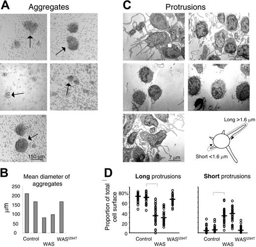 Figure 1. Human WAS B cells fail to form large homotypic aggregates and long protrusions. Peripheral blood B cells from WAS patients, healthy controls, or the WASI294T patient were stimulated with IL-4 and anti-CD40 mAbs for 5 days. (A) The extent of B-cell aggregation was assessed on fixed cells and representative images captured using an inverted microscope. Arrows indicate aggregates. (B) Quantitative determination of mean aggregate diameter. Per group, 5 to 20 aggregates were measured. (C) Electron microscopy of activated B cells. Representative images are shown. (D) Quantitative determination of membrane protrusions. Images of 30 individual cells in each group were captured under the electron microscope. The total membrane length of long (longer than 1.6 μm) and short (shorter than 1.6 μm) protrusions was measured. The measurements were done to cover the entire length of each protrusion, as explained in the image above panel D. Each symbol represents the relative amount of membrane covering long or short protrusions in a particular cell. Brackets indicate a significant difference of P < .001 using a 2-tailed t test.