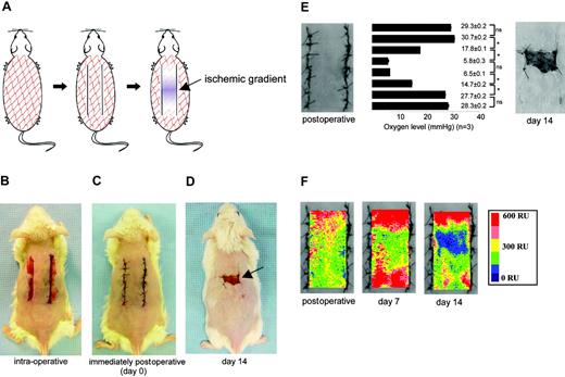 Figure 1. In vivo model of graded soft tissue ischemia. (A) Schematic diagram of a novel ischemia model consisting of paired skin incisions (black lines) along the dorsal surface of mice. (B) (C) (D) Parallel incisions penetrating the skin were made, and a silicone sheet was placed beneath the undermined tissue. The tissue was then reinserted to its original position (panel C), and gross evidence of necrosis (arrow) was evident in the central portion at 1 week following surgery (panel D). (E) Oxygen levels were measured by means of an oxygen probe, and a corresponding gradient of hypoxia was noted within the incised tissue at day 4 following surgery. (F) Color laser Doppler analysis of the incised skin also confirmed the presence of an ischemic gradient, with blood flow diminishing toward the central portion; the color scale illustrates variations in blood flow from maximum perfusion (red) to minimal perfusion (dark blue).