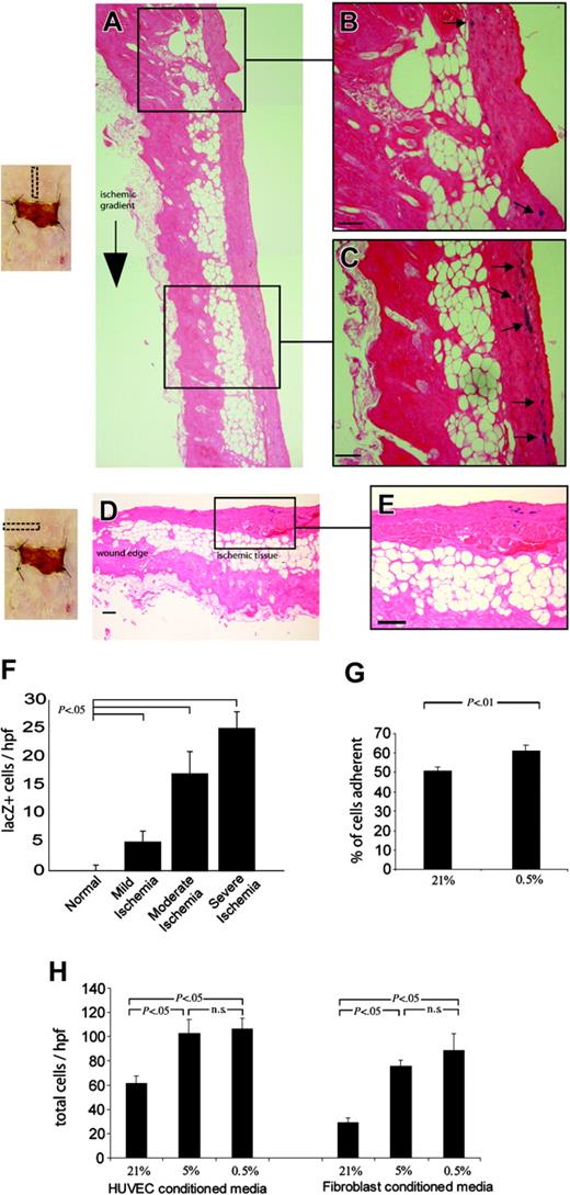 Figure 4. Selective homing of EPCs to ischemic tissue. Bone marrow–derived EPCs, identified by lacZ expression, were noted to be preferentially recruited to zones of severe ischemia. (A) (B) (C) (D) (E) Histologic sections taken along the axis of ischemia at day 7 are shown (panel A), with close-up views of the nonischemic (panel B) and ischemic (panel C) portions of the skin; lacZ+ EPCs stain blue and are highlighted with arrows. Transverse sections taken from the central portion of ischemic tissue at day 7 (panel D) reveal a considerable number of lacZ+ EPCs within the ischemic (panel E), but not incised, skin; (scale bars = 50 μm). (F) The number of lacZ+ EPCs recruited to regions of ischemia at day 7 was found to correlate inversely with the degree of ischemia; tissue sections were divided into zones of mild, moderate, and severe ischemia. (G) Human EPCs were then studied under hypoxic conditions in vitro and were noted to be significantly more adherent to endothelial monolayers exposed to 0.5% O2. (H) EPC chemotaxis was also studied by harvesting media from hypoxic cultures of endothelial cells and fibroblasts, and EPC migration toward hypoxic media (0.5% O2) from both cell types was significantly increased.