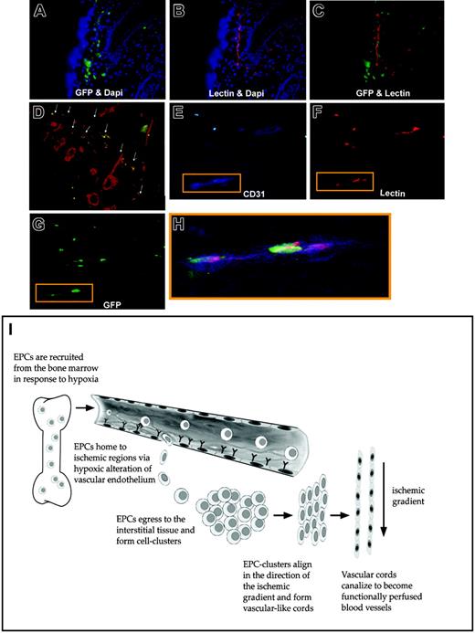 Figure 7. Differentiation of bone marrow–derived GFP+ cells into functional endothelial cells with a schematic of ischemia-induced vasculogenesis. A second bone marrow transplantation model was employed, in which mice were reconstituted with bone marrow cells ubiquitously expressing GFP+ (ie, not restricted to tie-2+ cells). Similar findings of bone marrow progenitor involvement during ischemic neovascularization were noted in these mice. (A) GFP+ (green) bone marrow–derived cells were recruited to ischemic tissue and formed vascular-like structures by day 14; blue staining (DAPI) represents all cell nuclei in the tissue. (B) Lectin (red) staining highlighted functional neovessels within the tissue oriented in the plane of ischemia. (C) Analysis of the tissue sections under multiple fluorescent windows identified vessels lined by bone marrow–derived EPCs. (D) Tissue sections were also taken perpendicular to the plane of ischemia, which similarly identified regions of costaining of lectin-perfused blood vessels (red) and BM-derived EPCs (green); arrows point to costained vessels, which appear orange. (E) (F) (G) GFP+ cells that lined blood vessels exhibited triple staining for CD31 (blue), lectin (red), and GFP (green). (H) An overlay of the triple staining is shown. (I) Schematic representation of the proposed mechanism by which EPCs contribute to neovascularization within ischemic tissue. Tissue ischemia causes the release of growth factors/cytokines (including VEGF), leading to a systemic response and the mobilization of BM-derived EPCs. Hypoxic conditions alter the vascular endothelium, causing circulating EPCs' arrest and egress into the tissue. Once in the interstitium, EPCs form cellular clusters and proliferate to increase the pool of cells available for neovascularization. Gradients of ischemia drive the formation of vascular cords in the direction of relatively hypoxic regions. Vascular cords tubulize and unite with existing vasculature, leading to increased tissue perfusion.