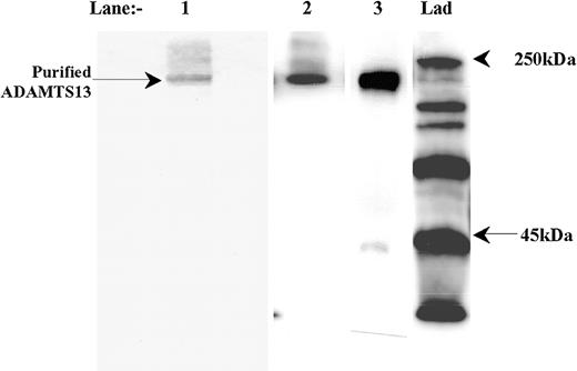 Figure 1. Purification of recombinant human ADAMTS13. ADAMTS13 was expressed by HEK293 cells stably transfected with the expression vector, pcDNA3.1/ADAMTS13/myc/His. ADAMTS13 was purified from conditioned medium Ni2+-HiTrap columns. Purified material was electrophoresed on a 7.5% polyacrylamide gel under nonreducing conditions and stained with Coomassie (lane 1). Lanes 2 and 3: Western blot analysis under reducing conditions with the anti-ADAMTS13 protease domain antibody and anti-myc epitope antibody, respectively. Lad = marker ladder