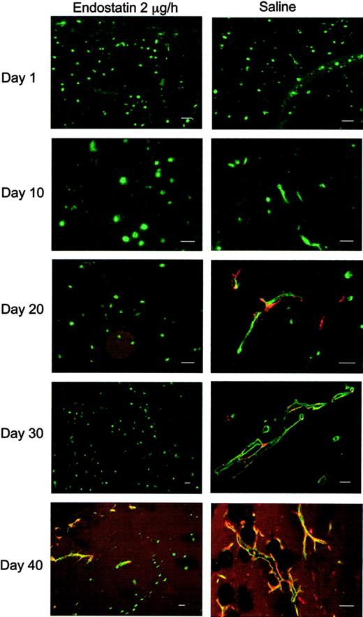 Figure 2. Endostatin inhibits capillary morphogenesis. Immunofluorescence staining for α-smooth muscle actin (red) and Ulex lectin-staining (green) of Matrigels from endostatin-treated and control animals. Note the few pericyte-covered vessels in endostatin-treated animals after 40 days. Scalebars, 50 μm.