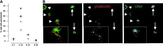 Figure 4. Endostatin inhibits the extension of F-actin–positive pseudopods in single endothelial cells. (A) Percentage of single cells extending pseudopods in endostatin-treated and control mice. (B) Single endothelial cells are either of an F-actin–expressing, pseudopod-extending phenotype (arrowheads) or a round phenotype with a low or absent expression of F-actin (arrows). Inserts show higher magnification. Scalebars, 50 μm.
