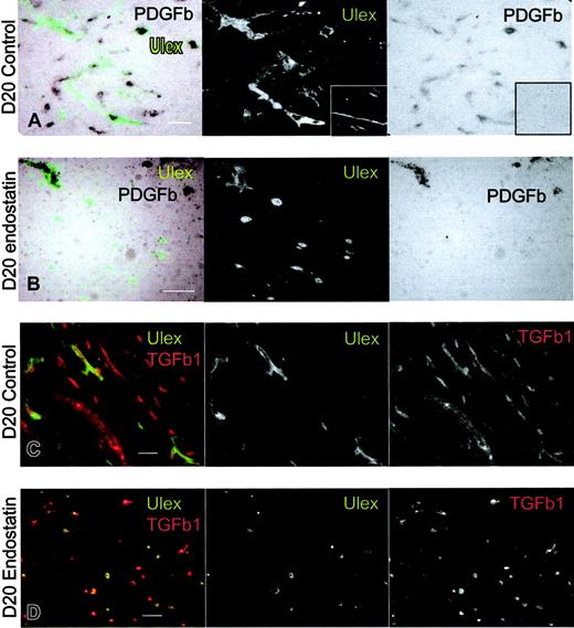 Figure 6. Endostatin inhibits the expression of endothelial PDGFB but not TGFβ1. Combined in situ hybridization of PDGFB (black) and immunofluorescense staining with Ulex lectin (green) in Matrigels from (A) control and (B) endostatin-treated animals at day 20. Note that the probe PDGFB also hybridizes to cells of mouse origin. Insert shows sense probe to PDGFB. (C-D) Immunofluorescence staining of TGFβ1 (red) and Ulex lectin (green) in Matrigels from day-20 control (C) and endostatin-treated (D) mice. Note that the antibody to hTGFβ1 also recognizes mouse TGFβ. Scalebars, 50 μm.