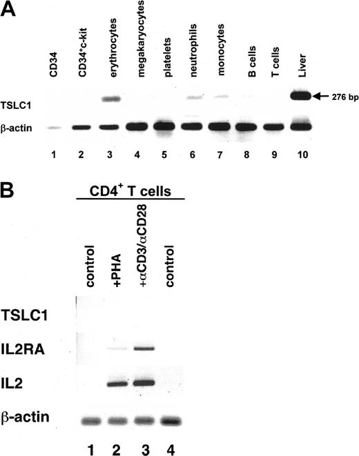 Figure 2. Expression of the TSLC1 gene in hematopoietic cells detected by RT-PCR. (A) Expression of the TSLC1 gene in cDNA from a series of hematopoietic cell fractions detected by RT-PCR. Each transcribed cDNA was amplified with the TSLC1-specific primer sets listed in “Patients, materials, and methods.” Each fraction of hematopoietic cells is indicated at the top of the lanes. Amplification of liver cDNA was used as a positive control (lane 10). (B) Expression of various genes in PHA-stimulated or unstimulated CD4+ T cells. Total RNA was prepared from CD4+ T cells stimulated with PHA or anti-CD3 and anti-CD28. cDNA was amplified using the primer sets for TSLC1, IL2RA, IL2, or β-actin as a quantitative control (described in “Patients, materials and, methods”). Control indicates unstimulated, +PHA, PHA-stimulated, and +αCD3/αCD28′, αCD3/αCD28′-stimulated CD4+ T cells.