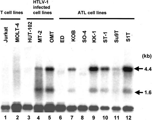 Figure 3. Expression of the TSLC1 gene in T-cell lines detected by Northern hybridization. Poly(A)+ RNA was prepared from various T-cell lines with or without HTLV-1 infection and from ATL cell lines, and TSLC1 expression was analyzed by Northern hybridization. Two bands, 4.4 and 1.6 kb, for TSLC1 transcripts were detected in 2 of 3 T-cell lines with HTLV-1 infection (lanes 4 and 5) and 5 of 7 ATL cell lines (lanes 7, 9, 10, 11, and 12). β-actin expression was used as a control for mRNA quantity.