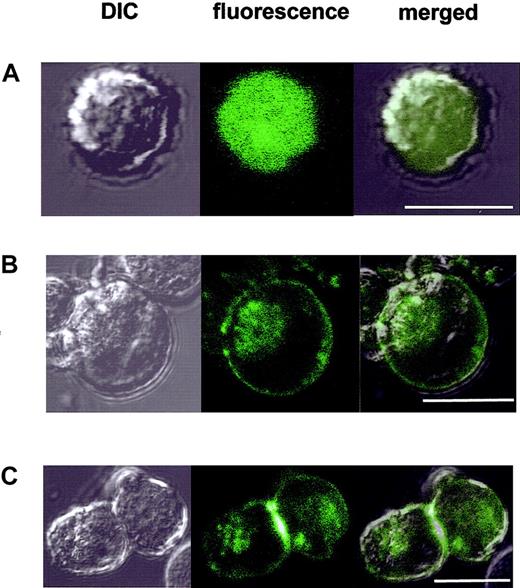 Figure 5. Subcellular localization of TSLC-GFP in CTLL2 cells. Subcellular distribution of GFP-fused TSLC1 (TSLC-GFP) in CTLL2 cells. C/GFP (column A) and C/TSLC-GFP (column B and C) cells were observed under a laser scanning confocal microscope (model TSC4D; Leica Microsystems, Frankfurt, Germany), objective × 40/0.75 NA, with a filter set suitable for GFP detection and differential interference contrast (DIC). Bars represent 10 μm.