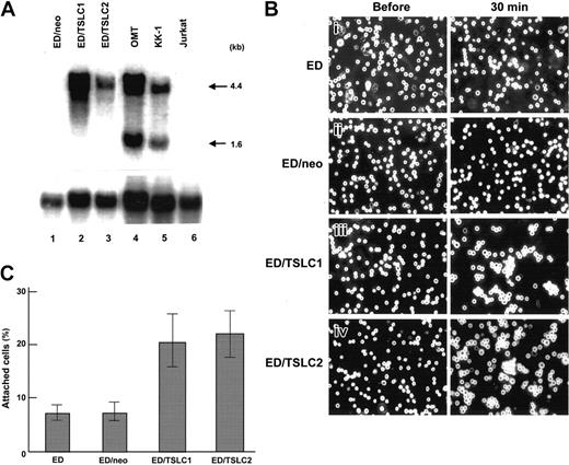 Figure 6. TSLC1 in ATL cell line plays an important role in adhesion to the vascular endothelial cells and self-aggregation. (A) Northern hybridization of TSLC1 in ED transformants. ED cells (ED/TSLC1 and ED/TSLC2) were transduced with a retrovirus vector containing the TSLC1 gene. A 4.4-kb band of TSLC1 transcript was detected in ED/TSLC1 and ED/TSLC2 cells (lanes 3 and 4). ED/neo (mock transformants) and Jurkat cells (lanes 1 and 6) were used as negative controls. OMT and KK-1 (lanes 4 and 5) were ATL cell lines as positive controls. (B) Cell aggregation experiments with TSLC1 transformants. To examine the aggregation activity of TSLC1 in parental ED cells, ED/TSLC1 and ED/TSLC2 transformants were well suspended just before the experiment and kept for 30 minutes in a 3.5-cm2 dish. Photographs were taken with an inverted microscope (model CKX41; Olympus, Tokyo, Japan) at a magnification of 100 × (objective × 10/0.25 NA). (C) Cell adhesion experiments with TSLC1 transformants. To examine the adhesion activity of TSLC1, parental ED, ED/neo, ED/TSLC1, and ED/TSLC2 were incubated with monolayer HUVECs for 30 minutes. Each value represents the average obtained from 3 independent experiments. Bars indicate standard deviation errors.