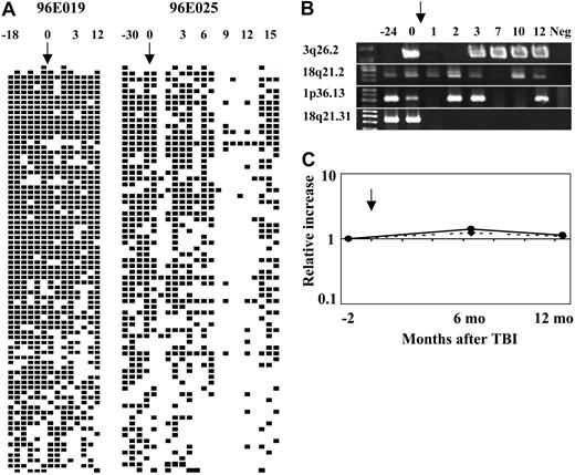Figure 4. Schematic summary of the detection of individual clones contributing to granulocyte production before and after 3 Gy TBI. (A) The left-hand panel shows results from animal 96E019 and right-hand panel results from animal 96E025, and includes all clones detected at least once in a total of 18 separate LAM-PCR reactions (3 independent sets of 6 replicates). ▪ represents the detection of a specific clone at least once from a given time; □, no detection of a specific clone; and ↓, the time of 3 Gy TBI. Each column represents a separate time point: animal 96E019 6 months after transplantation, 7 months after transplantation, 9 months after transplantation, 1 year after transplantation, 1 year 11 months after transplantation, 2 years after transplantation, 1 week after 3 Gy TBI, 1 month after 3 Gy TBI, 2 months after 3 Gy TBI, 4 months after 3 Gy TBI, 5 months after 3 Gy TBI, 6 months after 3 Gy TBI, 9 months after 3 Gy TBI, 1 year after 3 Gy TBI; animal 96E025 7 months after transplantation, 9 months after transplantation, 1 year after transplantation, 3 years after transplantation, 1 week after 3 Gy TBI, 2 weeks after 3 Gy TBI, 3 weeks after 3 Gy TBI, 1 month after 3 Gy TBI, 2 months after 3 Gy TBI, 3 months after 3 Gy TBI, 4 months after 3 Gy TBI, 5 months after 3 Gy TBI, 6 months after 3 Gy TBI, 7 months after 3 Gy TBI, 8 months after 3 Gy TBI, 9 months after 3 Gy TBI, 10 months after 3 Gy TBI, 11 months after 3 Gy TBI, 1 year after 3 Gy TBI, 1 year 2 months after 3 Gy TBI, 1 year 3 months after 3 Gy TBI, 1 year 4 months after 3 Gy TBI. The arrows indicate the time of 3 Gy TBI. Numbering above panels refers to time in months before and after 3 Gy TBI. (B) Use of insertion-specific PCR tracking primers to verify presence or absence of individual clones. The arrow indicates the time of 3 Gy TBI, 3 years after initial transplantation in animal 96E025. There were 4 insertion-specific primers designed to amplify individual insertion site clones from animal 96E025, initially identified from LAM-PCR on the pre-TBI sample. Each insertion-specific primer was used along with an LTR primer to amplify an individual insertion. Those clones chosen included 3q26.2 within the mds1 gene, 18q21.2 within the dcc gene, 1p36.13 within a repeat element, and 18q21.31 within the hak gene. The time points for amplification were 1 (1 year after transplantation); 2 (2 years 10 months after transplantation); 3 (3 weeks after 3 Gy TBI); 4 (2 months after 3 Gy TBI); 5 (3 months after 3 Gy TBI); 6 (7 months after 3 Gy TBI); 7 (10 months after 3 Gy TBI); 8 (1 year after 3 Gy TBI); 9 (negative control normal rhesus macaque DNA). This clone-specific PCR confirms the clonal instability seen by LAM-PCR, with many clones disappearing and reappearing, and a minority not detectable at the most recent follow-up, possibly indicating complete deletion. (C) Semiquantitative analysis of the level of contribution of clones 3q26.2 (straight line) and 1p36.13 (dashed line) to granulocytes from animal 96E025. The arrow indicates the time of 3 Gy TBI. The relative clonal contribution was normalized against β-actin, and the first time point (3 months before 3 Gy TBI) was chosen as a baseline level. By 6 and 12 months after TBI, the relative contribution to granulopoiesis from these clones was stable and not significantly changed compared with baseline.