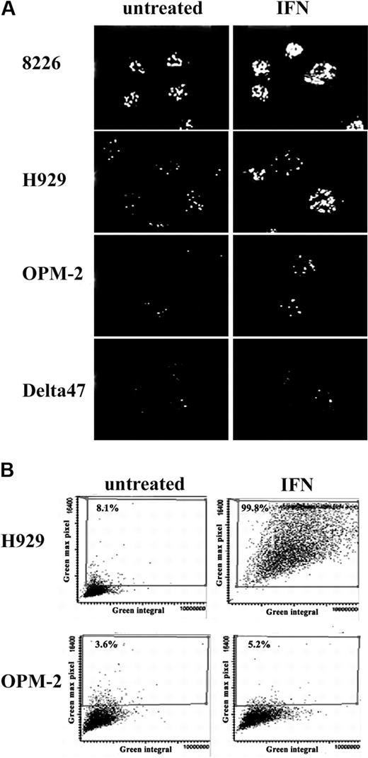 Figure 2. Confocal image and LSC analysis of PML NBs. (A) PML nuclear bodies induced by IFN-α (2000 U/mL) were visualized by immunostaining using monoclonal anti-PML. Pictures are a projection of confocal Z sections. (B) IFN-α–treated (2000 U/mL) and untreated H929 and OPM2 cells were immunostained with mouse monoclonal anti-PML followed by incubation with Alexa 488–conjugated secondary antibody. LSC analysis was performed as described in “Materials and methods”; 3000 cells per sample were scanned. PML NBs are represented by scattergrams of 2 parameters of LSC measurement. Green fluorescence integral represents overall fluorescent intensity within the nucleus, and green maximal pixels represent maximal fluorescent signal (brightest cells).