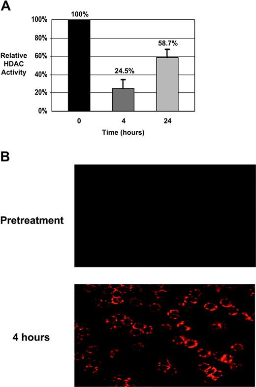 Figure 1. Biologic effects of depsipeptide in CLL patient cells. (A) CLL patient cells were isolated prior to therapy with depsipeptide, as well as immediately before treatment and 4 and 24 hours after the start of infusion. Lysates were prepared and analyzed for specific HDAC activity. Activity is shown as a percentage relative to baseline (pretreatment). Significant HDAC inhibition is noted at completion of infusion (4 hours) and diminishes by 24 hours. (B) CLL patient cells isolated before therapy and at 4 hours following the start of the infusion were analyzed by fluorescent immunocytochemistry using an antibody to acetylated H3. Acetylation of H3 is minimal at baseline but is evident in the majority of the cells at the 4-hour time point.