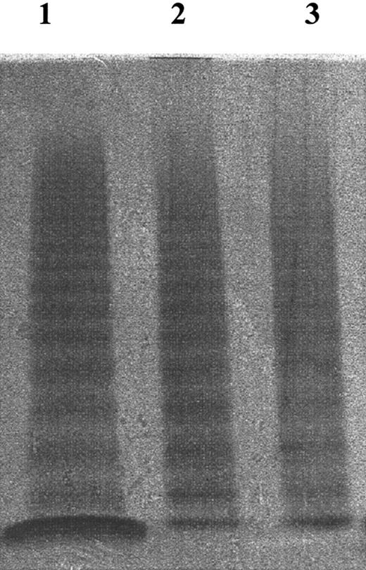 Figure 1. Multimeric structure analysis of VWF. VWF multimeric structure was analyzed by 2% SDS–2% agarose electrophoresis (see “Materials and methods”). Lane 1 indicates normal plasma; lane 2, purified VWF; lane 3, VWF/FVIII concentrate (supplied by Kaketsuken, Kumamoto, Japan). After adjusting the concentration of the samples to 1 VWF:RCo U/mL, they were subjected to electrophoresis. These VWF samples all contained VWF with similar multimeric structure.