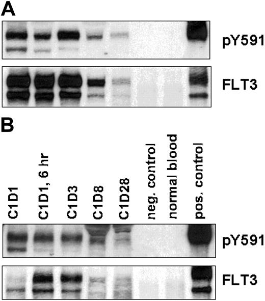 Figure 3. Analysis of Flt3 phosphorylation. Western blot analyses for phosphorylated and total Flt3 of patient no. 13 (Flt3-ITD) (panel A) and patient no. 8 (Flt3-D835) (panel B). Negative control represents whole blood lysate from a healthy donor, and positive control represents whole blood lysate from a healthy donor spiked with an Flt3-expressing cell line. C indicates cycle; D, the day of the cycle when blood was drawn; and pY591, flt3 phosphorylated at tyrosine 591.
