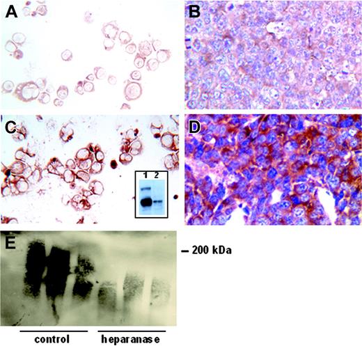 Figure 1. CAG myeloma cells transfected with the cDNA for human heparanase express high levels of the enzyme when growing either in vitro or in vivo. Neotransfected cells exhibit a low level of immunostaining for heparanase in vitro (A, cytospins) or in vivo (B, tissue section of a primary tumor). In contrast, heparanase-transfected cells stain intensely for heparanase in vitro (C, cytospin) and in vivo (D, primary tumor). (Original magnification, × 200.) The inset in panel C is a Western blot of extracts from CAG cells growing in culture. The presence of a low level of active heparanase (50 kDa) in the control-transfected cells (lane 2) and a high level of the active heparanase at 50 kDa in the heparanase-transfected cells (lane 1, bottom band) is apparent. A low level of the inactive form of the enzyme (65 kDa) is also present in the heparanase-transfected cells. Western blotting of syndecan-1 extracted from subcutaneous tumors demonstrates that the proteoglycan is dramatically reduced in size in the presence of elevated heparanase (E). Shown are the syndecans present in tumors from 3 mice bearing control-transfected cells and from 3 mice bearing heparanase-transfected cells (heparanase).