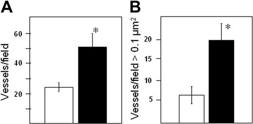 Figure 5. Heparanase expression enhances both the number and size of tumor blood vessels. Seven weeks after subcutaneous injection of tumor cells, tissue sections from primary tumors were stained with antibody to CD34. Both vessel density (A) and the number of large microvessels (B) are significantly higher in tumors expressing high levels of heparanase (▪) as compared with controls (□). *P = .0009 for vessel density and P = .0005 for vessel size. Vessel size is plotted as the number of vessels per field greater than 0.1 μm2. Error bars represent the mean plus or minus SD.