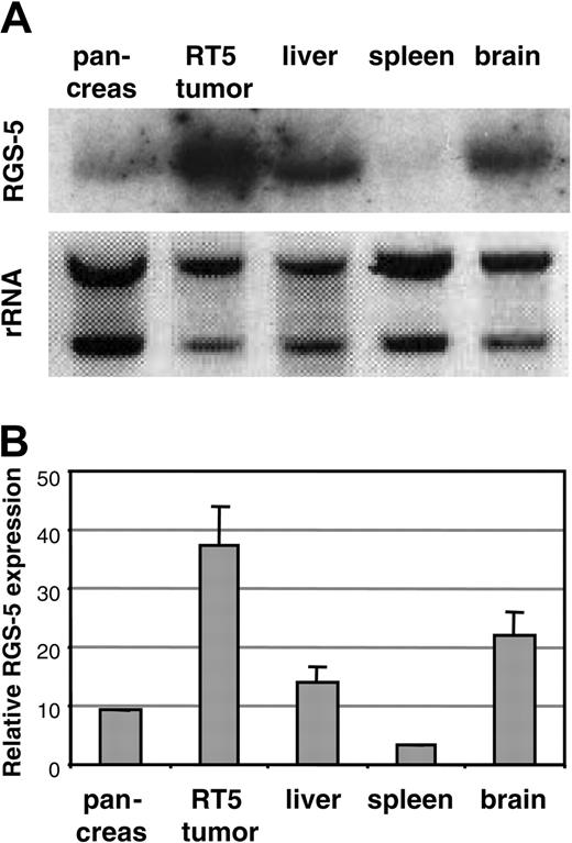 Figure 1. Murine RGS-5 is up-regulated in insulinomas. RGS-5 mRNA expression in normal mouse organs (brain, spleen, pancreas, and liver) and a pool of isolated solid tumors from 30-week-old RIP1-Tag5 (RT5) mice was examined by Northern blot (A) or RT-PCR analysis (B). The graph represents data from 3 to 5 organ samples. Error bars in all histograms represent SDs.