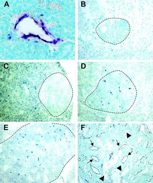 Figure 2. RGS-5 expression is restricted to angiogenic vessels and is up-regulated early during multistep tumorigenesis. RGS-5 transcripts are visualized using in situ hybridization on paraffin (A) or frozen tissue sections (B-F) and counterstained with methyl green. (A) RGS-5+ tumor blood vessel (original magnification × 25). In the same transgenic animal a normal islet of Langerhans (B, original magnification × 16) and a hyperplastic islet (C, original magnification × 12.5) are negative for RGS-5. (D) First RGS-5 signals are detected in early angiogenic islets (original magnification × 12.5) and the number of signals increases continuously in late angiogenic islets (E, × 10) and highly vascularized, solid tumors (F, original magnification × 5). Tumor vessels (arrows) can be distinguished from “blood lakes” (arrowheads), tumor cell–lined cavities, which do not participate in the blood circulation. Dotted lines indicate islet boundaries.