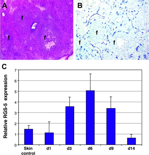 Figure 3. RGS-5 expression during physiologic neovascularization. (A-B) Consecutive frozen tissue sections of a mouse ovary stained with (A) hematoxylin and eosin or (B) after in situ hybridization with a RGS-5–specific riboprobe (f indicates follicles; original magnification × 12.5). (C) Relative RGS-5 expression levels during dorsal wound healing. RNA from 5 to 9 independent samples of untreated skin (control) and wounds at days 1, 3, 6, 9, and 14 was quantified by RT-PCR.