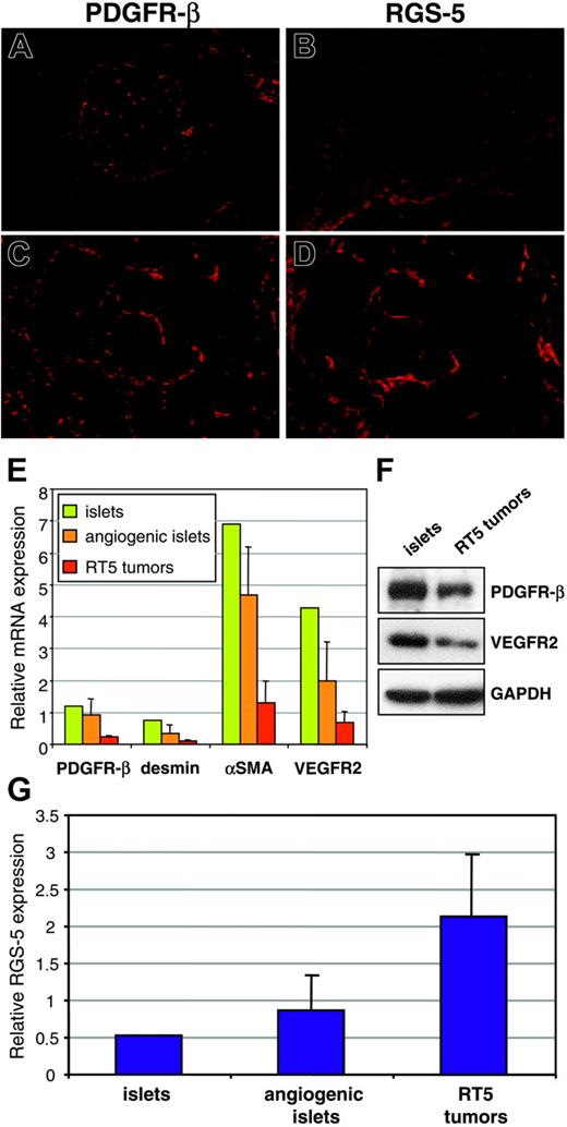Figure 5. Intratumoral PDGFR-β+ cells selectively up-regulate RGS-5. (A) Immunoreactivity of anti–PDGFR-β antibodies in normal pancreatic islets and (C) RIP1-Tag5 tumors is compared to RGS-5 in situ hybridization signals in islets (B) and tumors (D; for all frozen sections, original magnification × 10). (E) RNA from normal islets (1 pool of 200 islets), angiogenic islets (3 pools of 10 angiogenic islets), and tumors (12 independent tumor samples) was analyzed for the expression of known pericyte markers (PDGFR-β, desmin, αSMA) and for VEGFR2 as a marker for endothelial cells. (F) Western blot analysis of pools of islets and RT5 tumors. (G) Relative expression of RGS-5 in normal islets, angiogenic islets, and tumors is shown. Expression levels in panels E and G were normalized to HPRT.