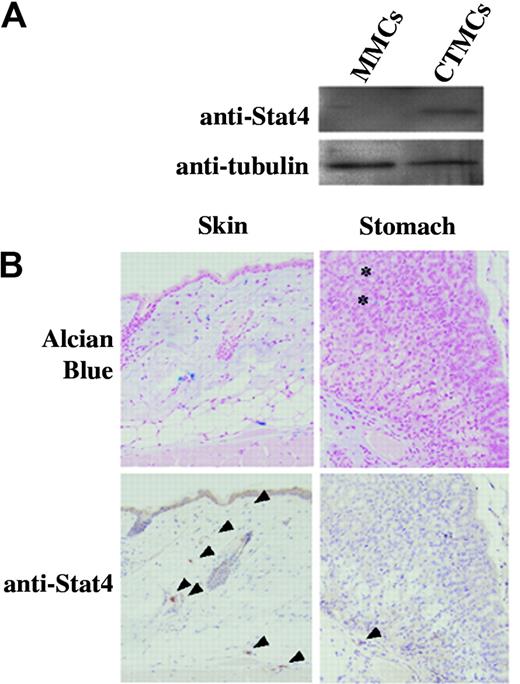 Figure 1. Expression of Stat4 protein in mast cells. (A) Western blot analysis of cultured MMCs and cultured CTMCs. Cell lysates were blotted with anti-Stat4 (C-20) and anti–α-tubulin Abs. (B) Immunohistochemical analysis of tissue mast cells derived from the skin and stomach of B6+/+ mice. Mast cells are identified as alcian blue–positive cells in the tissue. Anti–Stat4-reacted cells are indicated by arrowheads. Mucosal mast cells (asterisk) were not stained with anti-Stat4 Ab.