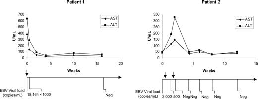 Figure 1. Changes in liver transaminases and EBV DNA levels are shown for patients no. 1 and no. 2 following treatment with rituximab. The timelines below the figures indicate the time points at which quantitative EBV-PCR was performed and the values that were obtained. The arrows above the timelines indicate when rituximab was administered. AST indicates aspartate aminotransferase; ALT, alanine aminotransferase; and Neg, negative.