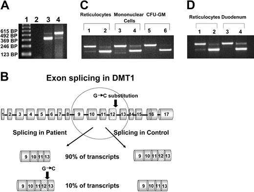 Figure 2. Amplification of the exon 9 to 13 region of DMT1 mRNA from reticulocytes. (A) RNA from the patient's reticulocytes and those of a healthy control was isolated, and total cDNA was synthesized as described in “Patients, materials, and methods.” The exon 9 to 13 region of DMT1 cDNA was amplified by PCR and the PCR products were separated on a 1% agarose gel. Lane 1, 123-bp ladder; lane 2, no template control; lane 3, patient's reticulocytes; lane 4, healthy control's reticulocytes. The upper band in lanes 3 and 4 corresponds to a size of 492 bp, the lower band in lanes 3 and 4 corresponds to a size of 372 bp. (B) Schematic representation of DMT1 pre-mRNA processing in the patient and in wild-type control. (C) Amplification of the exon 9 to 13 region of DMT1 mRNA from various hematopoietic cells. RNA from the patient's reticulocytes, mononuclear cells, and CFU-GMs, and from corresponding cells from a healthy control was isolated and total cDNA was synthesized. The exon 9 to 13 region of DMT1 cDNA was amplified by PCR, and the PCR products were separated on a 1% agarose gel. Lanes 1, 3, and 5 are from a healthy control; lanes 2, 4, and 6 are from the patient. Platelets and granulocytes from the patient and healthy controls were also examined and data were similar to mononuclear cells (data not shown). (D) Amplification of the exon 9 to 13 region of DMT1 mRNA from reticulocytes and duodenum. RNA was isolated from a small sample of the patient's duodenum (obtained at endoscopy) and from the duodenum of a healthy control, and total cDNA was synthesized. The exon 9 to 13 region of DMT1 cDNA was amplified by PCR, and the PCR products were separated on a 1% agarose gel. Lanes 1 and 3 are from a healthy control; lanes 2 and 4 are from the patient.