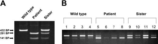Figure 3. Comparison of exon 12–skipping in various tissues from wild-type, patient, and patient's sister (heterozygote). (A) Genomic DNA was isolated from reticulocytes and the exon/intron boundary of exon 12/intron 12, and was amplified by PCR. PCR products were subjected to digestion with BsiW I endonuclease and then analyzed on a 1% agarose gel. (B) RNA was isolated from mononuclear cells, granulocytes, platelets, and reticulocytes, and total cDNA was synthesized. The exon 9 to 13 region of DMT1 cDNA was amplified by PCR and the PCR products were separated on a 1% agarose gel. Lanes 1, 5, and 9 are from mononuclear cells; lanes 2, 6, and 10 are from granulocytes; lanes 3, 7, and 11 are from platelets; lanes 4, 8, and 12 are from reticulocytes.