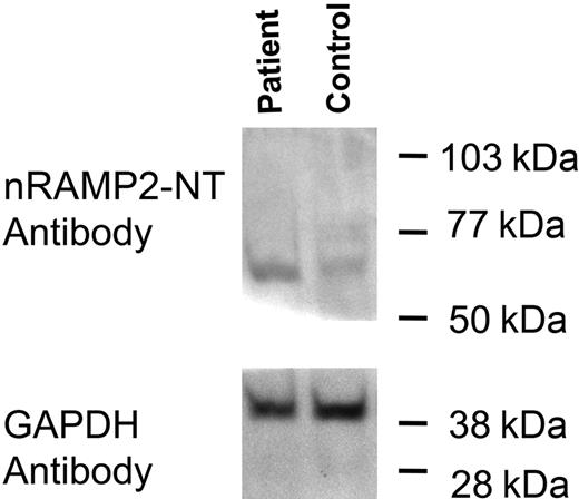 Figure 4. Detection of DMT1 protein in duodenum. Total duodenal extract was prepared as described: 22 μg total protein was loaded into each lane and separated by SDS-PAGE on a 10% acrylamide gel followed by transfer to PVDF membrane. Membranes were cut in half just below the 50-kDa standard; the upper half of the blot was incubated with the nRAMP2-NT antibody, whereas the lower half was incubated with the GAPDH antibody as an internal loading control.