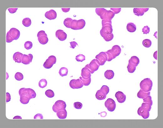 Peter Maslak, Memorial Sloan-Kettering Cancer Center