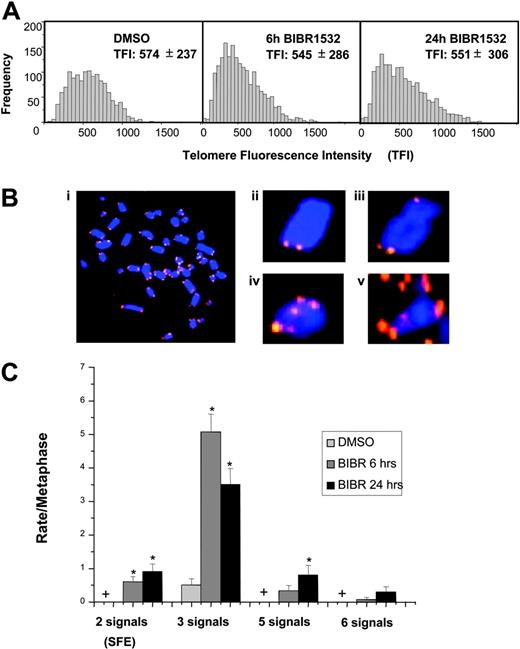 Figure 5. High-dose BIBR1532 induces telomere dysfunction in JVM13 cells. Individual telomere length was analyzed by quantitative fluorescence in situ hybridization (Q-FISH) as described previously.28,37 The number of analyzed metaphases was between 8 and 15 (Table 4). (A) The histograms represent telomere fluorescence intensity values (TFI) of JVM13 cells treated with 80 μM BIBR1532 compared with DMSO control at indicated time points. Values represent means ± SD. (B) The presence of telomere spots was counted at individual sister chromatids. (i) Representative metaphase spread from JVM13 cells treated with 80 μM BIBR1532. (ii) Chromosome missing 2 telomere signals. (iii) Chromosome missing one telomere signal from 1 chromatid (= 3 signals). (iv) Chromosome showing 5 telomere signals. (v) Chromosome showing 6 telomere signals (end-to-end fusion). (C) Graphic summary of number of telomere spots/chromosome deviating from the normal distribution of 4 telomeres per chromosome. The values represent mean ± standard error. * indicates a significant difference from cells treated with DMSO (P < .05); + indicates zero events for DMSO-treated cells.