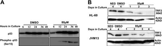 Figure 6. Western blot analysis of TRF2 and p53/phospho-p53 in leukemia cells treated with BIBR1532. Protein was extracted using RIBA buffer from HL-60 and JVM13 treated with 80 μM BIBR1532 at indicated time points. Western blot analysis was performed using a monoclonal (A) anti-p53 and anti-phosphorylated p53 (dilution 1:1000) and (B) anti-TRF2 antibody (dilution 1:250). Actin expression levels were used as internal control.
