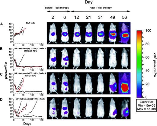 Figure 5. Biophotonic imaging of ffLuc+ Daudi cells before and after adoptive T-cell therapy. Scatter graphs of tumor flux versus time and pseudocolor images of selected mice (red lines) representing light intensity from ffLuc+ Daudi cells in the peritoneum of NOD/scid mice serially imaged in ventral position. On day 0, NOD/scid mice were given 5 × 106 ffLuc+ Daudi cells by intraperitoneal injection. (ffLuc+ Daudi in vitro ffLuc activity was 141 ± 8 CPM/cell (mean ± SD), compared with 0.05 CPM/cell background ffLuc activity in parental Daudi cells.) The mice with progressive disease, documented by 2 concurrent measurements demonstrating increase in tumor flux (measured on days 2 and 6), were among 4 treatment groups. The 5 mice from group A received no further cellular therapy. On day 7, the 5 mice in groups B, C, and D received 20 × 106 MP1-tetramer+CD19R+CD8+ T cells by intraperitoneal injection. Mice from group D received additional injections of 20 × 106 MP1-tetramer+CD19R+CD8+ effector T cells on days 9 and 12. On days 7, 9, 12, 21, 23, and 25, the mice in groups B and C received separate intraperitoneal injections of 5 × 106 thawed and γ-irradiated autologous hygromycin B-resistant T-APC that had been genetically modified with HyMP1-pMG (group B) or pMGP̂ac (group C) coding for HyMP1 and Hy genes, respectively. All mice received rhIL-2 (25 000 U/mouse) by separate intraperitoneal injection on days 7, 9, 12, 21, 23, and 25. Each mouse was imaged at the same relative time point after D-luciferin administration, which was within 19 minutes of injection. Data are presented as photon flux for a region of interest (ROI) encompassing the whole mouse. Similar data were obtained in repeated experiments (data not shown).