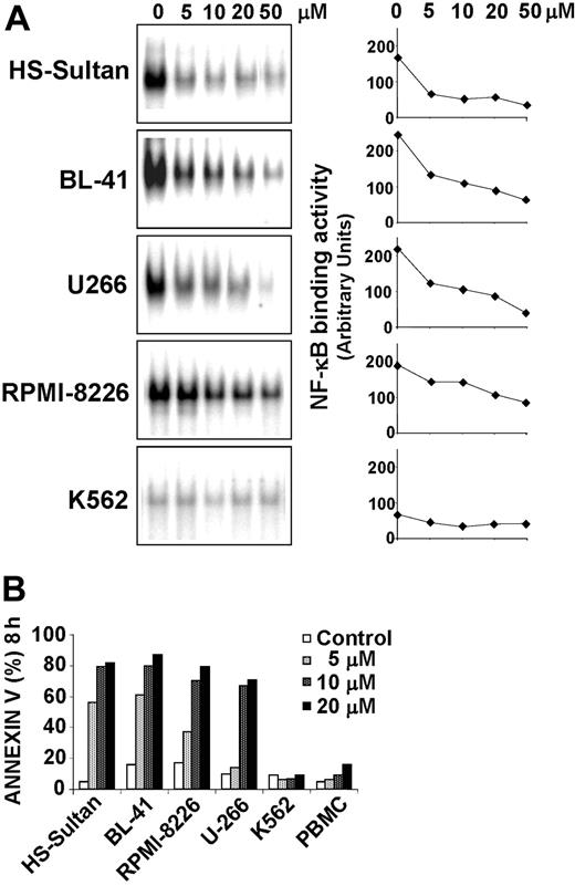 Figure 6. 15d-PGJ2 inhibits constitutive NF-κB binding activity and induces apoptosis in different types of B-cell malignancies. (A) Burkitt lymphoma HS-Sultan and BL-41 cells, multiple myeloma U266 and RPMI-8226 cells, and acute leukemia K562 cells (0.5 × 106 cell/mL) were treated with the indicated concentration of 15d-PGJ2 for 3 hours and tested for NF-κB DNA-binding activity by EMSA (left column). The levels of NF-κB DNA-binding activity were quantified by MDP analysis and expressed as arbitrary units (right column). (B) HS-Sultan, BL-41, RPMI-8226, U266, and K562 cells, and healthy donor peripheral blood mononucleated cells (PBMC) were treated with 15d-PGJ2 at the indicated concentrations (control represented by open bars; 5 μM, light gray bars; 10 μM, dark gray bars; 20 μM, filled bars) for 8 hours. Apoptosis was evaluated by FACS analysis of annexin V+ cells.