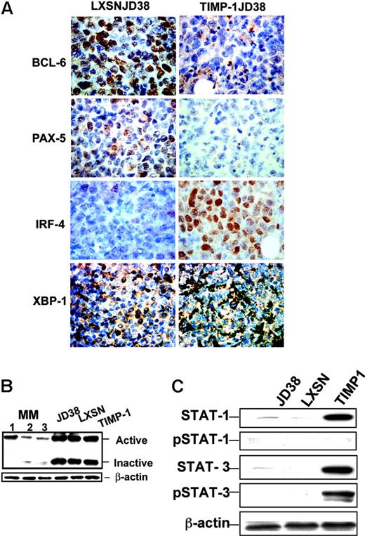 Figure 3. TIMP-1 effect on transcription regulators. (A) Immunohistochemistry showing down-regulation in TIMP-1JD38 tumor of the Tfs BCL-6 and PAX-5 and increasing expression of MUM-1/IRF-4; original magnification × 400. LXSN-JD38 and TIMP-1JD38 xenotransplants express XBP-1; original magnification × 400. (B) Western blot showing equal ratios of XBP-1 active/inactive forms by JD38 control cells and TIMP-1JD38 cells as compared with multiple myeloma cell lines (1, 2, and 3) in which the XBP-1 active form is up-regulated. (C) Western blot analysis confirms STAT-1 and STAT-3 up-regulation by TIMP-1 and demonstrates phosphotyrosine-activated STAT-3 and not STAT-1 in TIMP-1JD38 cells. Equal protein loading was monitored by β-actin Western blot.