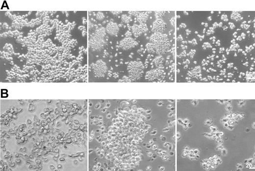 Figure 1. The structure of TAMs as monitored by phase contrast microscopy. CD14+ cells were cultured for 3 days in medium alone (left column) or in the presence of 100 nM Trx80 (to generate TAMs; middle column) or GM-CSF + IL-4 (right column). Panels A and B show different magnifications (see the size bars).
