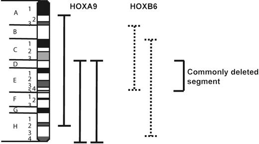 Figure 7. HOXB6-induced AMLs have recurrent cytogenetic abnormalities that span a common chromosomal region with HOXA9-induced AML. Schematic diagram of murine chromosome 2 indicating region of overlap in deletions observed in HOXB6- and HOXA9-induced AMLs.