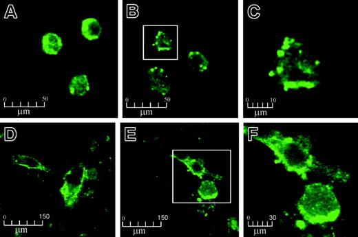 Figure 1. The effect of APC on EPCR on monocytes and HUVECs by confocal microscopy. Monocytes and HUVECs were incubated with 100 nM APC for 2 hours and stained with EPCR antibody RCR-49, as described in “Materials and methods.” Monocytes and HUVECs are shown at × 630 magnification before treatment (A and D, respectively) and after APC incubation (B and E, respectively). Panels C and F represent further magnifications (× 4) of the boxed cells from panels B and E, respectively.