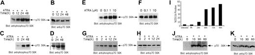 Figure 1. All-trans-retinoic acid induces phosphorylation of the p70 S6 kinase. (A) NB-4 cells were treated with RA (1 μM) for the indicated times. Equal amounts of total cell lysates were analyzed by SDS-PAGE and immunoblotted with an antibody against the phosphorylated/activated form of the p70 S6 kinase on threonine 421 and serine 424. (B) The blot shown in panel A was stripped and reprobed with an anti-p70 S6 kinase antibody, to control for protein loading. (C) MCF-7 cells were treated with RA (1 μM) for the indicated times. Equal amounts of total cell lysates were analyzed by SDS-PAGE and immunoblotted with an antibody against the phosphorylated/activated form of the p70 S6 kinase on threonine 421 and serine 424. (D) The blot shown in panel C was stripped and reprobed with an anti-p70 S6 kinase antibody, to control for protein loading. (E) NB-4 cells were treated for 48 hours with the indicated doses of RA. Equal amounts of total cell lysates were analyzed by SDS-PAGE and immunoblotted with an antibody against the phosphorylated/activated form of the p70 S6 kinase on threonine 421 and serine 424. (F) The blot shown in panel E was stripped and reprobed with an anti-p70 S6 kinase antibody, to control for protein loading. (G) NB-4 cells were treated with RA for the indicated times. Equal amounts of total cell lysates were analyzed by SDS-PAGE and immunoblotted with an antibody against the phosphorylated/activated form of the p70 S6 kinase on threonine 421 and serine 424. (H) The blot shown in panel G was stripped and reprobed with an anti-p70 S6 kinase antibody, to control for protein loading. (I) RA-dependent induction of cell differentiation. NB-4 cells were incubated with RA for the indicated times in hours. The cells were subsequently stained with an anti-CD11b monoclonal antibody and analyzed by flow cytometry. (J) NB-4 cells were treated with RA for the indicated times. Equal amounts of total cell lysates were analyzed by SDS-PAGE and immunoblotted with an antibody against the phosphorylated/activated form of the p70 S6K. (K) The blot shown in panel J was stripped and reprobed with an anti-p70 S6K antibody.