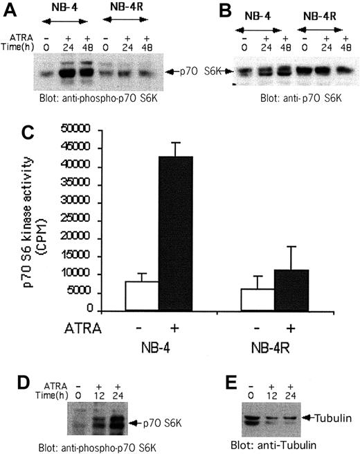 Figure 2. RA induces phosphorylation of p70 S6 kinase in NB-4 cells and primary APL blasts, but not in the RA-resistant NB-4.007/6 (NB-4R) cell line. (A) NB-4 or NB-4.007/6 cells were treated with RA (1 μM) for the indicated times. Equal amounts of total cell lysates were analyzed by SDS-PAGE and immunoblotted with an antibody against the phosphorylated/activated form of p70 S6 kinase on threonine 421 and serine 424. (B) The blot shown in panel A was stripped and reprobed with an anti-p70 S6 kinase antibody, to control for protein loading. (C) RA activates the kinase domain of p70 S6 kinase in NB-4, but not NB-4R, cells. NB-4 and NB-4R cells were treated with RA for 48 hours. The cells were subsequently lysed, and equal amounts of protein were immunoprecipitated with an anti-p70 S6 kinase antibody or nonimmune rabbit immunoglobulin (RIgG). In vitro kinase assays to detect p70 S6K activity were subsequently carried out on the immunoprecipitates. Kinase activity is expressed as CPM (counts per minute) after normalizing for nonspecific activity present in RIgG immunoprecipitates. Means plus or minus the standard error (SE) of 2 independent experiments are shown. (D) Isolated peripheral blood mononuclear cells from a patient with acute promyelocytic leukemia were treated with RA (1 μM) for the indicated times. Equal amounts of total cell lysates were analyzed by SDS-PAGE and immunoblotted with an antibody against the phosphorylated/activated form of p70 S6 kinase on threonine 421 and serine 424. (E) The blot shown in panel D was stripped and reprobed with an anti-tubulin antibody, to control for protein loading.