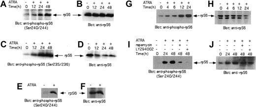 Figure 4. RA-induced phosphorylation of the S6 ribosomal protein (rpS6). (A) NB-4 cells were incubated with RA (1 μM) for the indicated times. Equal amounts of total cell lysates were analyzed by SDS-PAGE and immunoblotted with an antibody against the phosphorylated form of rpS6 on Ser240/244. (B) The blot shown in panel A was stripped and reprobed with an anti-rpS6 antibody, to control for protein loading. (C) NB-4 cells were incubated with RA (1 μM) for the indicated times. Equal amounts of total cell lysates were analyzed by SDS-PAGE and immunoblotted with an antibody against the phosphorylated form of rpS6 on Ser235/236. (D) The blot shown in panel C was stripped and reprobed with an anti-rpS6 antibody, to control for protein loading. (E) HL60 cells were incubated with RA (1 μM) for 48 hours. Equal amounts of total cell lysates were analyzed by SDS-PAGE and immunoblotted with an antibody against the phosphorylated form of rpS6 on Ser240/244. (F) The blot shown in panel E was stripped and reprobed with an anti-rpS6 antibody, to control for protein loading. (G) NB-4 cells were incubated with RA (1 μM) for indicated times. Equal amounts of total cell lysates were analyzed by SDS-PAGE and immunoblotted with an antibody against the phosphorylated form of rpS6 on Ser235/236. (H) The blot shown in panel G was stripped and reprobed with an anti-rpS6 antibody, to control for protein loading. (I) NB-4 cells were incubated with RA for indicated times and 2.5 hours prior to cell lysis indicated inhibitors were added in the cultures. Equal amounts of total cell lysates were analyzed by SDS-PAGE and immunoblotted with an antibody against the phosphorylated form of rpS6 on Ser240/244. (J) The blot shown in panel I was stripped and reprobed with an anti-rpS6 antibody, to control for protein loading.