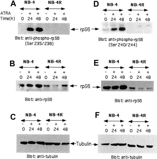 Figure 5. RA induces phosphorylation of rpS6 in NB-4 cells, but not in RA-resistant NB-4.007/6 (NB-4R) cells. (A) NB-4 or NB-4.007/6 cells were treated with RA (1 μM) for the indicated times. Equal amounts of total cell lysates were analyzed by SDS-PAGE and immunoblotted with an antibody against the phosphorylated form of the rpS6 on Ser235/236. (B) The blot shown in panel A was stripped and reprobed with an anti-rpS6 antibody. (C) The same blot, shown in panels A and B, was stripped and reprobed with an anti-tubulin antibody. (D) NB-4 or NB-4.007/6 cells were treated with RA (1 μM) for the indicated times. Equal amounts of total cell lysates were analyzed by SDS-PAGE and immunoblotted with an antibody against the phosphorylated form of the rpS6 on Ser240/244. (E) The blot shown in panel D was stripped and reprobed with an anti-rpS6 antibody. (F) The same blot, shown in panels D and E, was stripped and reprobed with an anti-tubulin antibody.