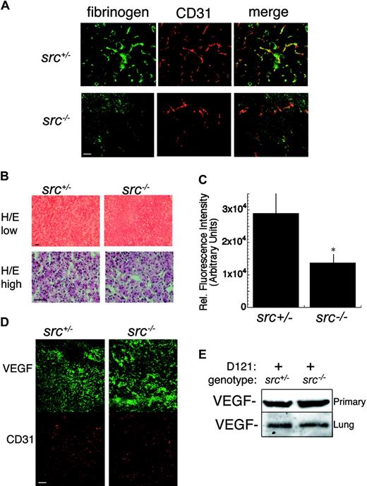 Figure 1. Reduced colocalization of fibrinogen degradation products (FDPs) and CD31 in Src-deficient mice. (A) Indirect immunofluorescence of cryosections of control (src+/–) and Src-deficient (src–/–) primary D121 subcutaneous tumors (12 day) immunostained with an antifibrinogen antibody (labeled with a green secondary antibody, left column) and an anti-CD31 antibody (labeled with a red secondary antibody, middle column). Images are merged in the right-hand column. Quantitation of the degree of colocalization was performed on multiple representative tumor cryosections immunostained to detect CD31 and fibrinogen. The Pearson coefficient for colocalization of CD31 and fibrinogen in control D121 tumors (src+/– and wild type) was 0.72+/–0.04 and for src–/– mice it was 0.37 +/– 0.11 (n = 6 for each, P < .004). These coefficients were calculated as described in “Materials and methods.” Bar = 50 μm. (B) Micrograph of hematoxylin/eosin-stained primary D121 tumors grown in src+/– and src–/– mice at low (top row) and high (bottom row) magnification. Micrographs are representative of triplicate staining assays. Bar = 33 μm. (C) Tumor-induced VP was determined in D121 tumor-bearing lungs from src+/– and src–/– by intravenous injection of 70-kDa FITC-dextran, removal of the intact lungs, homogenization, and quantitation with a fluorescent spectrophotometer as described in “Materials and methods.” (*P < .05; n = 4). Error bars indicate standard error. (D) Indirect fluorescent immunostaining with anti-VEGF (labeled with a green secondary, top row) and anti-CD31 (labeled with a red secondary, bottom row) antibodies of cryosections of primary D121 tumors grown in src+/– and src–/– mice (n = 3). Bar = 100 μm. (E) Whole tissue lysates were prepared from D121 primary tumors (top row) and secondary spontaneous lung tumors (12 day, bottom row) from src+/– and src–/– mice. Immunoblots are representative of triplicate Western blots.