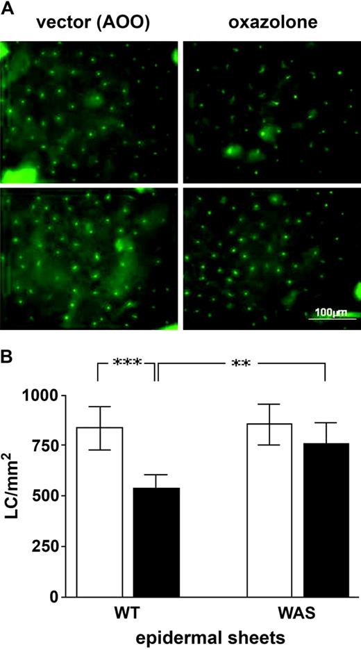 Figure 5. Migration of WASp-null LCs out of the epidermis is diminished. (A) Epidermal sheets were prepared following topical application of 0.1% oxazolone in AOO (acetone and olive oil) or AOO alone (vector). Staining with I-Ab+–FITC identified LCs and revealed fewer numbers of these cells in normal animals that had been sensitized compared with those treated with vector alone. In contrast, LC numbers in WASp-null sensitized animals were comparable in number to untreated animals. Top row, WT cells; bottom row, WASp-null. (B) Chart LC frequency in epidermal sheets prepared following topical application of 0.1% oxazolone in AOO (▪) or of AOO alone (vector, □). Oxazolone resulted in a marked fall in LC density compared with vector-treated WT mice (***P < .001; Student t test). This drop in LC density was also greater in normal compared with WASp-null sensitized animals (**P < .005). Additionally LC numbers from oxazolone-treated WASp-null mice did not vary significantly from vector-treated animals. The data shown are representative of 2 experiments in which n = 3 mice. Error bars indicate standard deviation.