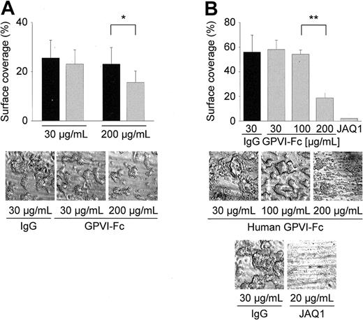 Figure 2. Effect of hGPVI-Fc on platelet adhesion. Heparinized whole blood from healthy volunteers (A) or wild-type mice (B) was incubated with the indicated concentrations of hGPVI-Fc () or control IgG (▪) for 2 minutes and perfused at wall shear rates of 1000 seconds–1 (4 minutes) over a collagen-coated surface. Mouse blood was also tested in the presence of JAQ1 (20 μg/mL). Surface area covered by thrombi is summarized in the upper panels (mean ± SD of 5 experiments per group). Control bar (B) represents blood from wild-type mice incubated with 30 μg/mL of irrelevant IgG, but similar results were also obtained with higher concentrations (not shown). Bottom panels show representative phase-contrast images taken at the end of the experiment. (*P < .05; **P < .01)
