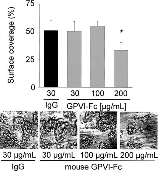Figure 6. Effect of mGPVI on platelet adhesion. Heparinized whole blood from wild-type mice was incubated with the indicated concentration of mouse GPVI-Fc (gray bars) or the same concentration of control IgG (black bar) for 2 minutes and perfused at wall shear rates of 1000 seconds–1 (4 minutes) over a collagen-coated surface. Surface area covered by thrombi is summarized in the upper panels (mean ± SD of 5 experiments per group). Control bar represents blood from wild-type mice incubated with 30 μg/mL of irrelevant IgG, but similar results were also obtained with higher concentrations (not shown). Lower panels show representative phase-contrast images taken at the end of the experiment. (*P < .05)