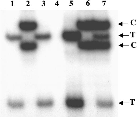 Figure 4. Transcriptional clonality assay of G6PD in human CD33+ cells isolated from mice that received transplants of IM PB CD34+ cells. Lanes 1-3 show clonal expression of G6PD in human CD33+ cells from 3 individual mice, each given transplants of CD34+ cells from a different female IM patient: IM-1 (lane 1), IM-2 (lane 2) and IM-3 (lane 3). Lane 4 shows negative control. Lane 5 shows positive control for clonal expression of G6PD on T allele. Lane 6 shows positive control for clonal expression of G6PD on C allele. Lane 7 shows positive control for polyclonal expression of G6PD on both T and C alleles.